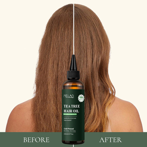 Scalp Care Oil923