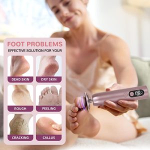 Electric Foot Callus Remover80630