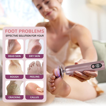 Electric Foot Callus Remover80630