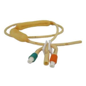 Stomach Feeding Tube82054