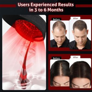 Red Light Therapy Helmet81969