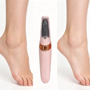 Electric Foot Callus Remover80632