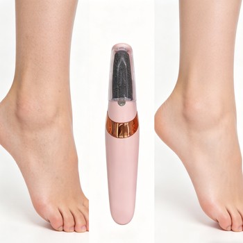 Electric Foot Callus Remover80632