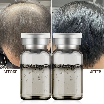 Scalp Care Serum79237