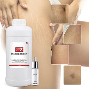 Stretch Mark Removal Cream80325