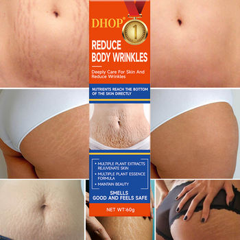 Stretch Mark Removal Cream87067
